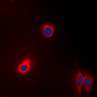 EEF2 Rabbit Polyclonal Antibody