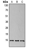 4EBP1 (Phospho-T37) Rabbit Polyclonal Antibody