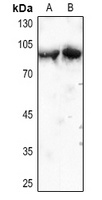 Cortactin Rabbit Polyclonal Antibody