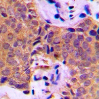Cortactin Rabbit Polyclonal Antibody