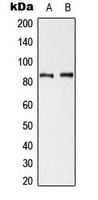 Cortactin (Phospho-Y421) Rabbit Polyclonal Antibody