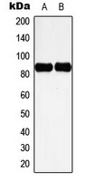 Cortactin (Phospho-Y466) Rabbit Polyclonal Antibody