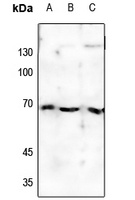 Estrogen Receptor alpha (Phospho-S118) Rabbit Polyclonal Antibody