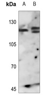FGFR1 Rabbit Polyclonal Antibody
