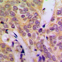 c-SRC Antibody [KO/KD Validated]