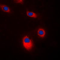 c-SRC Antibody [KO/KD Validated]