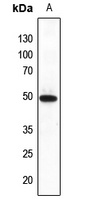 FNTB Rabbit Polyclonal Antibody