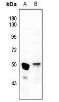 GATA4 Rabbit Polyclonal Antibody