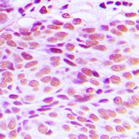 GATA4 Rabbit Polyclonal Antibody