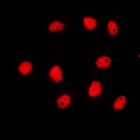 GATA4 Rabbit Polyclonal Antibody