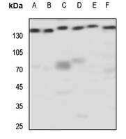 mGLUR5 Antibody