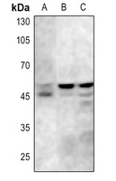 GSK3 alpha/beta (Phospho-Y279/216) Antibody