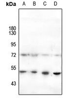 HNF4 alpha (Phospho-S313) Rabbit Polyclonal Antibody