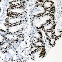 HNF4 alpha (Phospho-S313) Rabbit Polyclonal Antibody