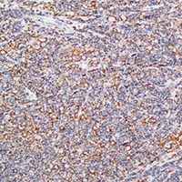 IL-10 Antibody