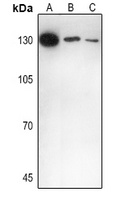 IL-16 Rabbit Polyclonal Antibody