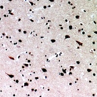 IL-16 Rabbit Polyclonal Antibody