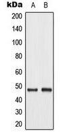 c-Jun (Phospho-T93) Rabbit Polyclonal Antibody