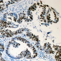 Lamin A/C (Phospho-S392) Rabbit Polyclonal Antibody