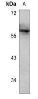 LYN (Phospho-Y508) Rabbit Polyclonal Antibody