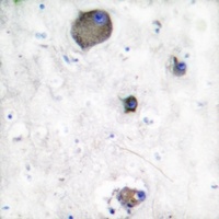 LYN (Phospho-Y508) Rabbit Polyclonal Antibody