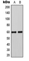 SMAD3 (Phospho-S425) Rabbit Polyclonal Antibody