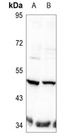TAU (Phospho-T498) Rabbit Polyclonal Antibody