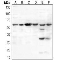 MDM2 (Phospho-S166) Antibody