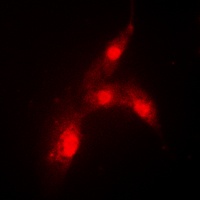 MDM2 (Phospho-S166) Antibody