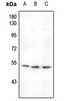 MEF2A (Phospho-T319) Rabbit Polyclonal Antibody