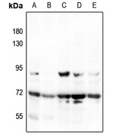 MEKK3 Rabbit Polyclonal Antibody