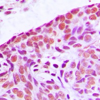 MEKK3 Rabbit Polyclonal Antibody