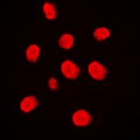 MEKK3 Rabbit Polyclonal Antibody