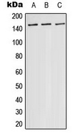 ASK1 Rabbit Polyclonal Antibody