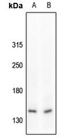 c-Met (Phospho-Y1234) Rabbit Polyclonal Antibody