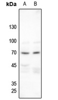 Merlin (Phospho-S518) Rabbit Polyclonal Antibody
