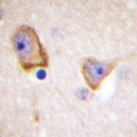 Mu Opioid Receptor Rabbit Polyclonal Antibody