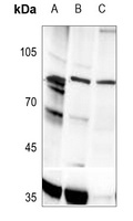 PLA2G4A (Phospho-S505) Rabbit Polyclonal Antibody