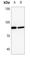 PLA2G4A Rabbit Polyclonal Antibody