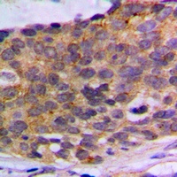 PLA2G4A Rabbit Polyclonal Antibody
