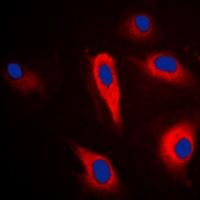 PLA2G4A Rabbit Polyclonal Antibody