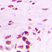 PLK1 (Phospho-T210) Rabbit Polyclonal Antibody