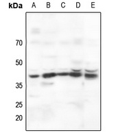 AMPK beta 1 Rabbit Polyclonal Antibody