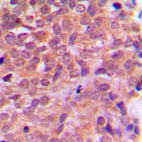 AMPK beta 1 Rabbit Polyclonal Antibody