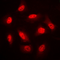 AMPK beta 1 Rabbit Polyclonal Antibody