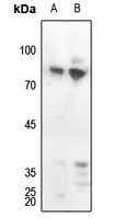 PKC delta (Phospho-Y313) Rabbit Polyclonal Antibody