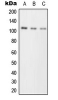 PKC mu Rabbit Polyclonal Antibody