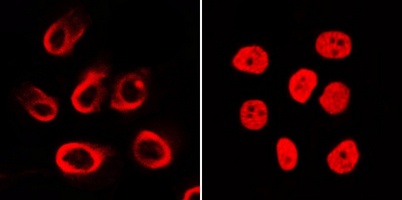 TRITC IF Detection System Kit (Goat Anti-Rabbit)