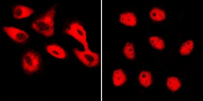 TRITC IF Detection System Kit (Rabbit Anti-Sheep)