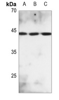 MKK2 (Phospho-T394) Rabbit Polyclonal Antibody